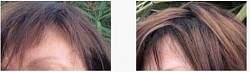 Repousse des cheveux, traitement naturel contre la perte des cheveux